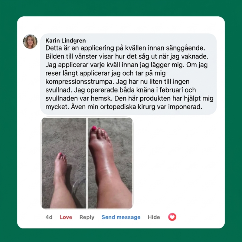 Kundomdöme från Karin – tydlig minskning av svullnad